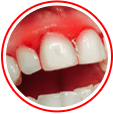 Supports The Oral Microbiome for Strong Teeth & Gums